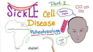 Sickle Cell Disease “part 2”  Pathophysiology [upl. by Ardnikal683]