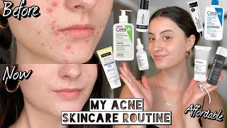 A Dermatologist’s Nighttime Skincare Routine for Hormonal Acne amp Dry Skin  Skincare Expert [upl. by Thorner]