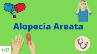 Alopecia Areata Causes SIgns and Symptoms Diagnosis and Treatment [upl. by Perle529]