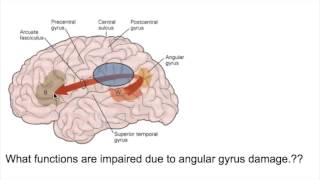 PROSOPAGNOSIA Face blindnessANGULAR GYRUS LESIONS [upl. by Nagey118]