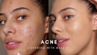 HOW TO COVER ACNE WITH MAKEUP BASE ROUTINE [upl. by Eboj]