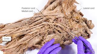 Brachial Plexus and Axillary Artery [upl. by Brok]