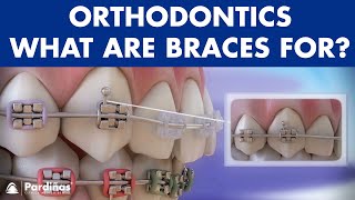 How Braces Work Elements of the orthodontic treatment and its role © [upl. by Dorothea]