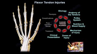 Flexor Tendon Injuries  Everything You Need To Know  Dr Nabil Ebraheim [upl. by Ahsihat]