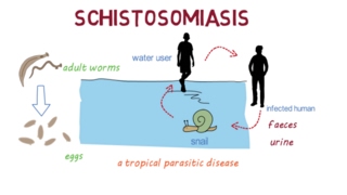 Schistosomiasis Bilharzia– an overview [upl. by Eidoc]