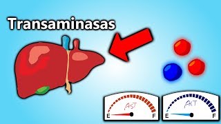 Transaminasas Altas EXPLICACIÓN EN 5 MINUTOS  Patología Clínica101 [upl. by Nelo]