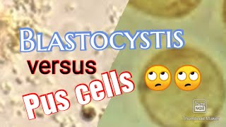 Skill Lab13 Blastocystis hominis versus pus cells [upl. by Fletcher]