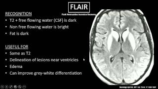 MRI Sequences [upl. by Moon12]