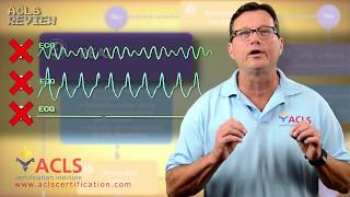 ACLS Adult Cardiac Arrest Algorithm  PEAAsystole [upl. by Nirtiak]