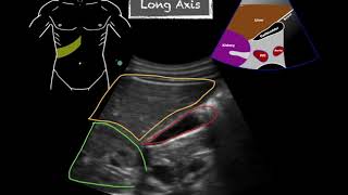 POCUS  Gallbladder Ultrasound Anatomy [upl. by Nydia]