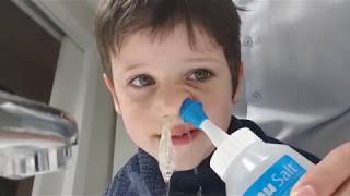 Cómo limpiar la sinusitis a un niño [upl. by Issak]