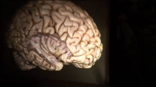 The Brain Surface Sulci amp Gyri by Guilherme Carvalhal Ribas MD [upl. by Anailli]