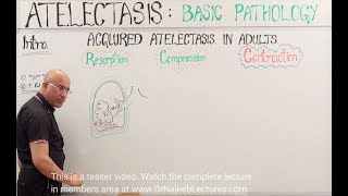 Atelectasis  Resorption Compression and Contraction [upl. by Simon116]