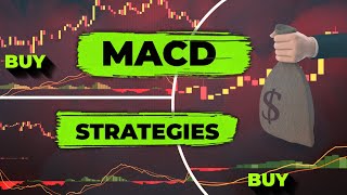 Ultimate MACD Trading Guide For Beginners Forex Crypto amp Stock MACD Strategies [upl. by Eeznyl]