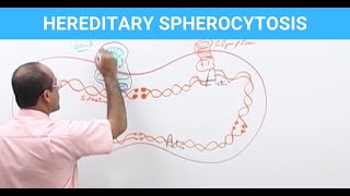 Hereditary Spherocytosis  Diagnosis amp Treatment  Genetics👨‍⚕️ [upl. by Eppie906]