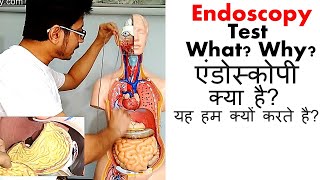 Endoscopy test in Hindi [upl. by Nolla]