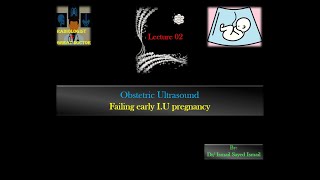 Obstetric Ultrasound Lecture 02 Failing early IU pregnancy [upl. by Feriga]