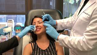 Prevent Smile Lines and Wrinkles Botox to Crows Feet [upl. by Yrneh819]