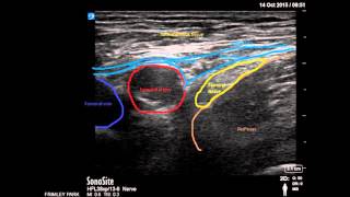 Femoral nerve glide floss 4 [upl. by Eniac]