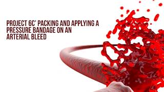 Packing and applying a pressure bandage on an arterial bleed [upl. by Erodoeht]