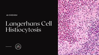 What is Langerhans Cell Histiocytosis [upl. by Eimot686]