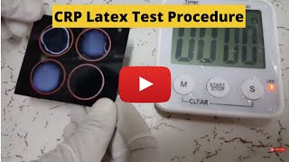 CReactive Protein Test CRP Latex Test Procedure [upl. by Venola85]