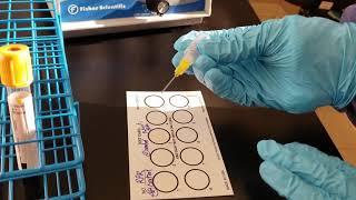 Microbiology Rapid Plasma Reagin RPR Test [upl. by Gherardo21]