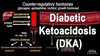 Diabetic Ketoacidosis DKA Pathophysiology Animation [upl. by Bronwyn]