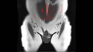 Anatomia RM pelvis y caderas [upl. by Dale103]