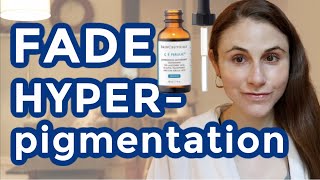 Hyperpigmentation Treatment Options [upl. by Ardnekan211]