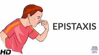 Epistaxis Causes SIgns and Symptoms Diagnosis and Treatment [upl. by Seton176]