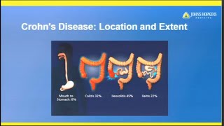 BadGut® Lecture Irritable Bowel Syndrome IBS  Gastrointestinal Society [upl. by Atnwahsal151]