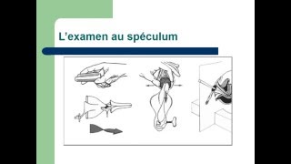 GYNECOLOGIE L’examen en gynécologie [upl. by Binky]