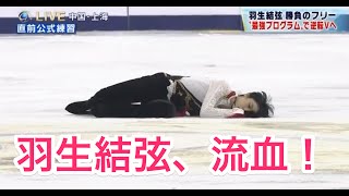 羽生結弦、流血！ 中国選手との衝突の瞬間！！ [upl. by Dnilazor]