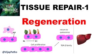 TISSUE REPAIR Part 1 Repair  Regeneration [upl. by Alma]