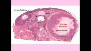 Treatment of Ovarian Cysts [upl. by Zaccaria]