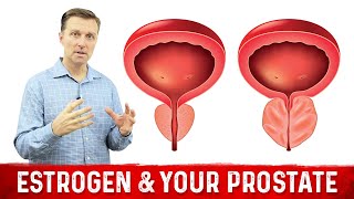 How To Fix Enlarged Prostate Explained By Dr Berg [upl. by Neelhtakyram]