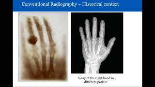 Radiotherapy and Radiography Explained [upl. by Schaefer129]