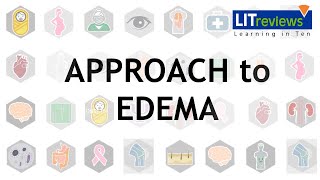 Approach To Edema [upl. by Azirb]