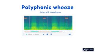 Lung sounds  polyphonic wheeze [upl. by Stuppy]