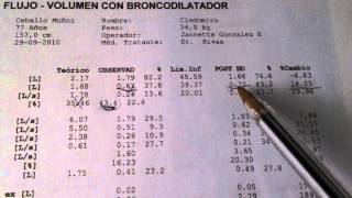 Espirometria Interpretacion Simple [upl. by Rotsen578]