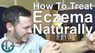 How To Treat Eczema Naturally [upl. by Eniroc126]