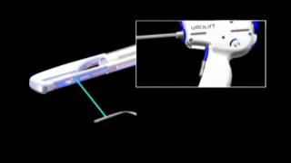 UroLift Procedure for BPH  Dr David Harris [upl. by Eskill]