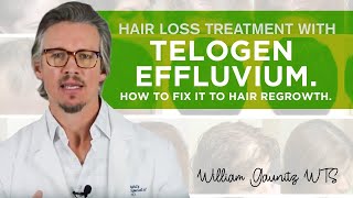 Telogen Effluvium Hair Loss  What is it How To Fix It Fast [upl. by Gothurd666]