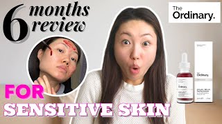 The Ordinary Peeling Solution For Sensitive Skin  6 Months Honest Review [upl. by Nakasuji]