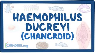 Haemophilus ducreyi Chancroid  an Osmosis Preview [upl. by Ume144]