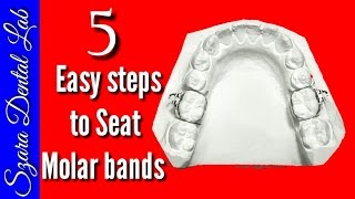 5 Easy steps Seating Ortho Bands [upl. by Seely295]