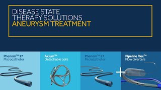 Aneurysm Treatment Solutions [upl. by Mond]