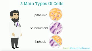 Kaposi Sarcoma 5Minute Pathology Pearls [upl. by Lama]