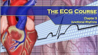 The ECG Course  Junctional Rhythms [upl. by Ikcim]